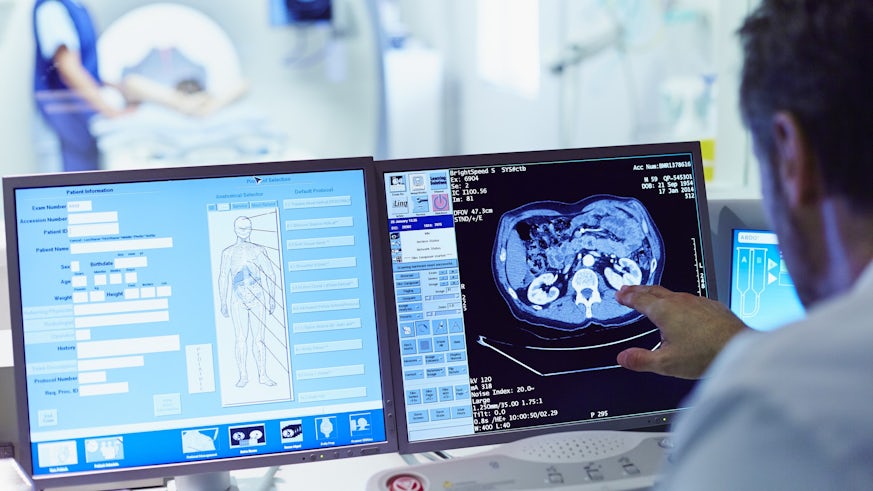 A clinician is examining MRI data on a computer screen