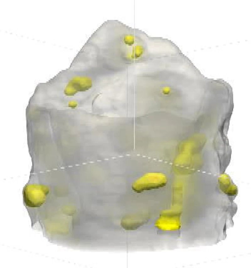 Tomography
