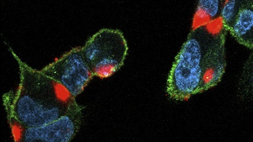 SARS-CoV-2-infected cells (cell nucleus in blue, cell surface in green and viral proteins in red)