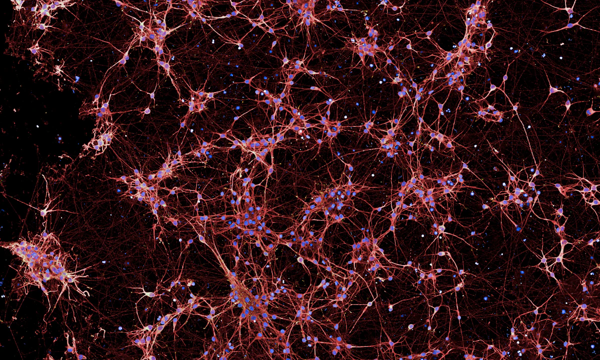 An image of purple brain neurons on a black background.