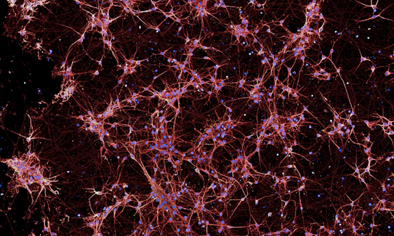 An image of purple brain neurons on a black background.
