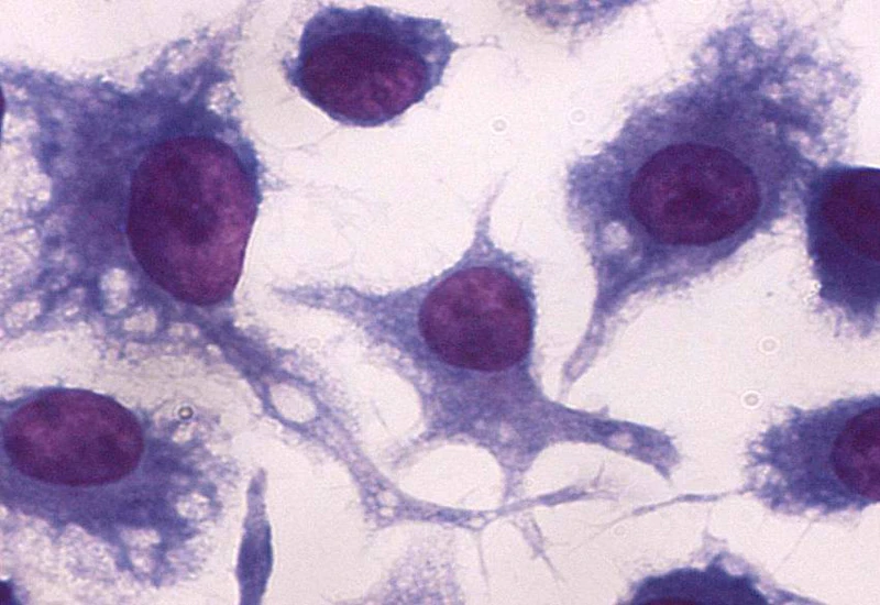 Adherent macrophages