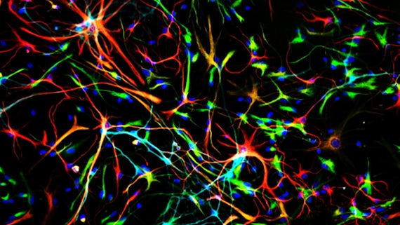 Hippocampal stem cells, which generate new neurons, growing in a dish in the lab