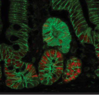Cancer and Cell Signalling