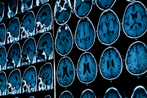 Brain Imaging