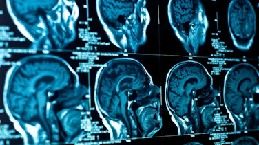 Brain scans
