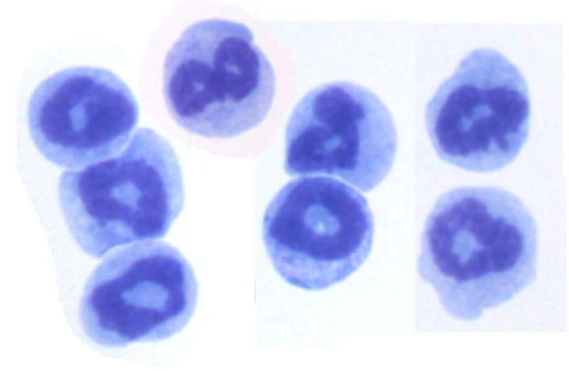 Neutrophils