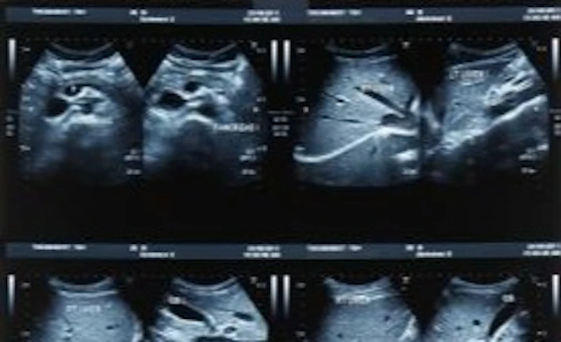 Medaphor