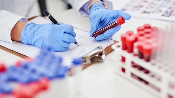 Scientist checking blood samples