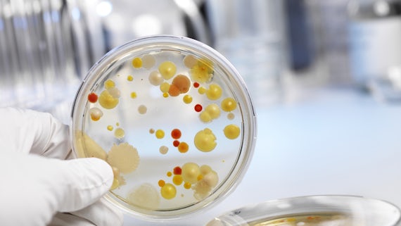 Petri dish containing bacteria 