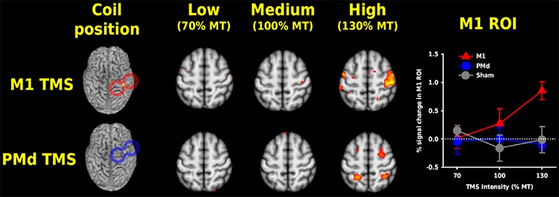 Concurrent TMS And MRI - Cardiff Cognition And Neurostimulation Group ...