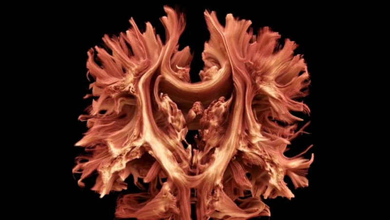 A detailed brain scan conducted at CUBRIC