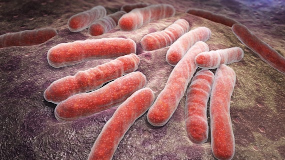 Bacterial TB