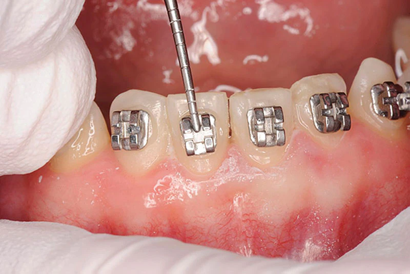 ortho