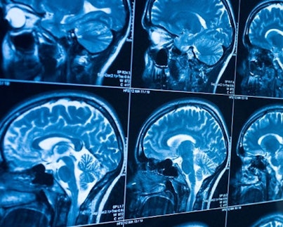 Peirianneg er iechyd