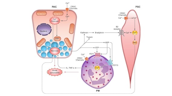 New concept of acute pancreatitis showing interactions between three different cell types