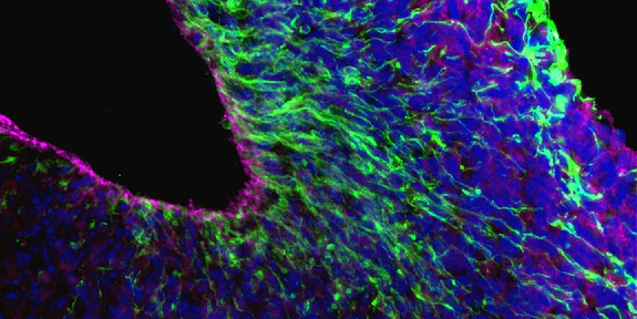 Brain cells in dish