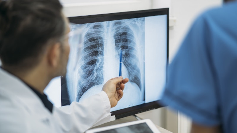 Knowing where to look: researchers create AI to examine medical images like a trained radiologist