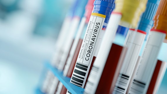 Stock image of COVID-19 test tubes