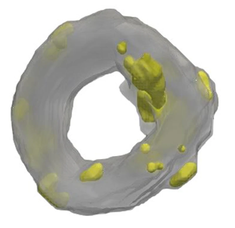 Tomography