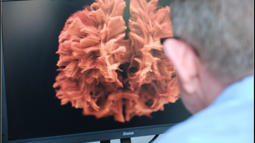 Professor Derek jones viewing a screen displaying a brain model