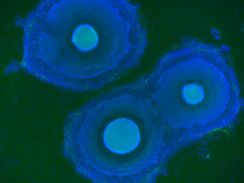 stem