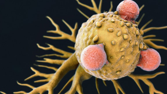 [Resim: T-cells-attacking-cancer-ed.jpg?w=575&ar=16:9]