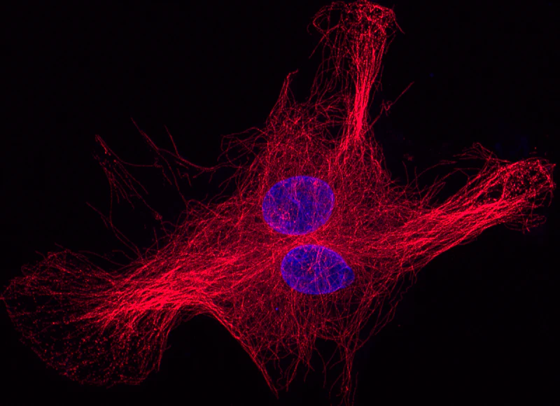 Neurodegeneration and Ageing