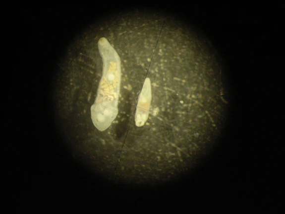 Otter gall bladder parasites under microscope