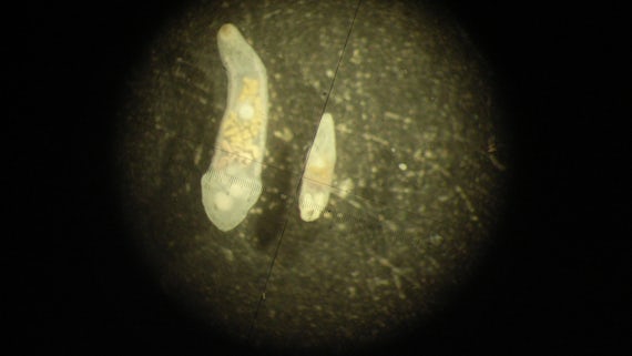 Otter gall bladder parasites under microscope