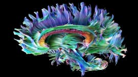 Microstructure MRI scan of a human brain