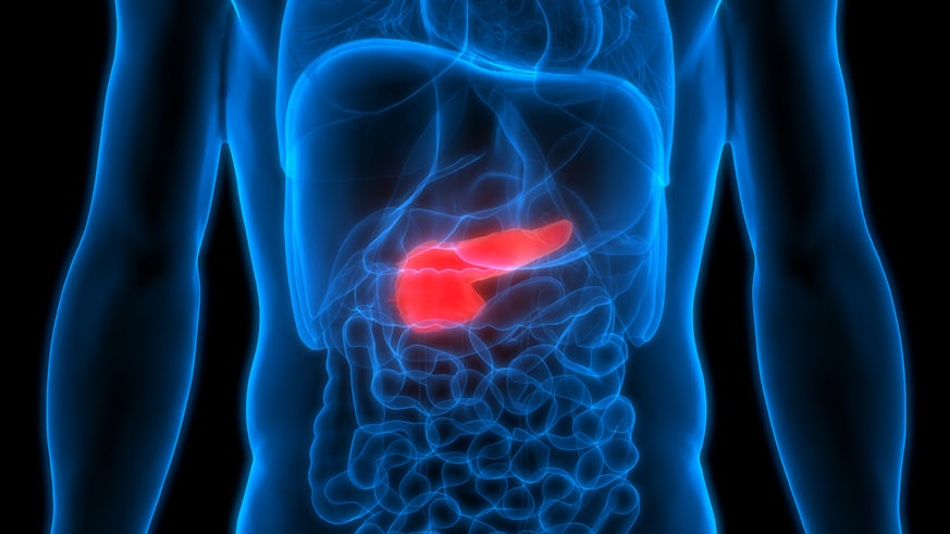 Artist's impression of torso and pancreas scan