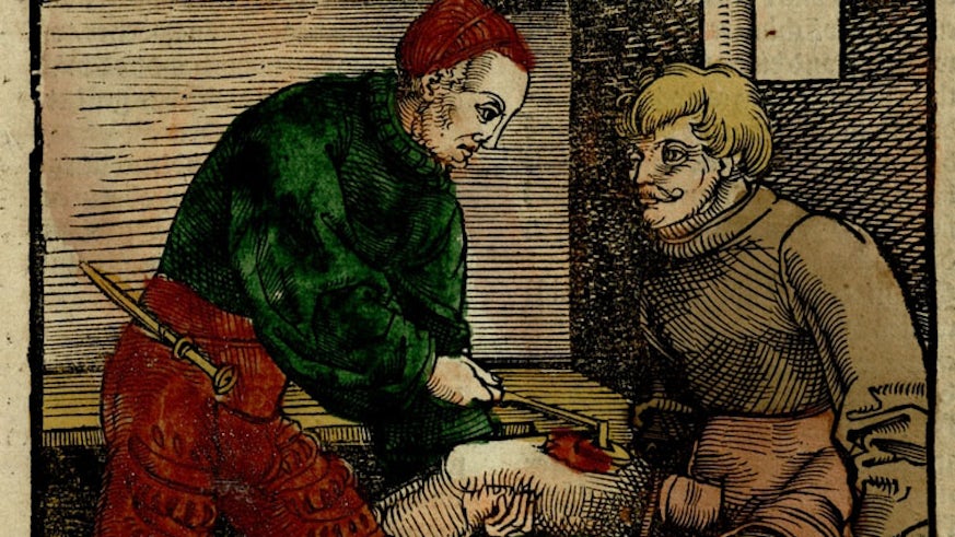 Woodcarving of a doctor cauterizing a wound on a man's thigh.