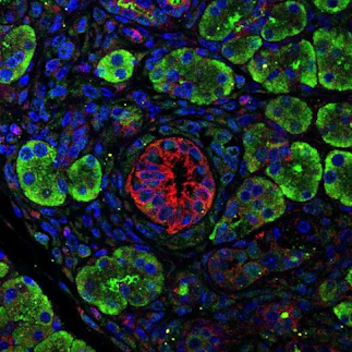 Cell-cell interactions in early carcinogenesis 