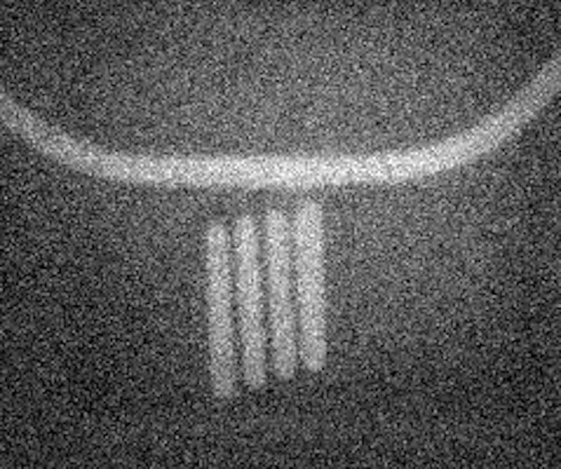 Structure of a remotely pinned magnetic domain wall