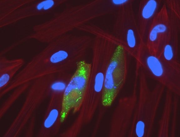 Persistent and Resistant Infection