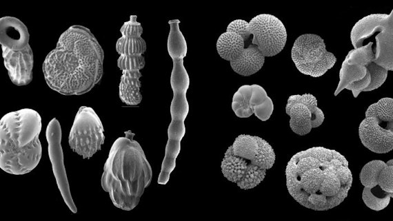 Black and white image of fossil plankton