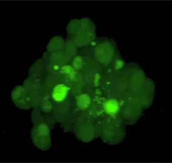 Targeting Metastasis